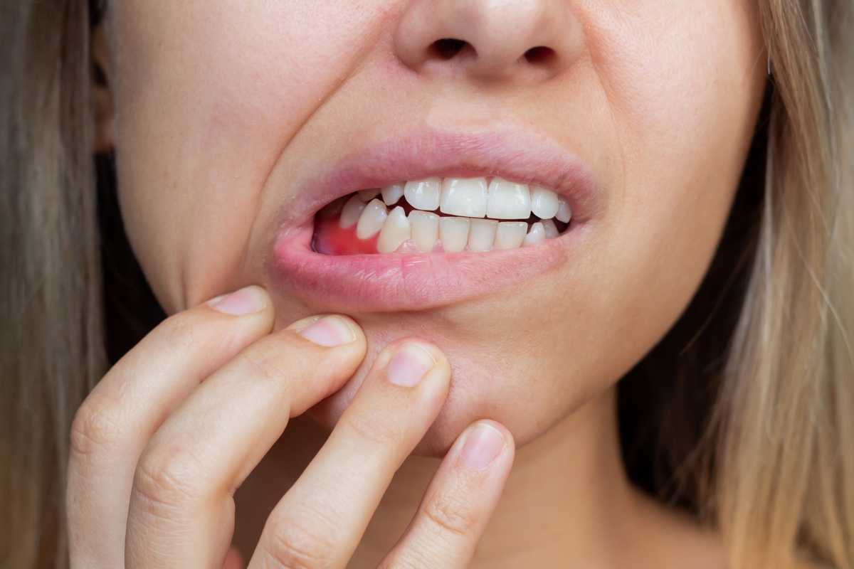 Qué es la enfermedad periodontal - CENTRO MIGUEL GONZÁLEZ