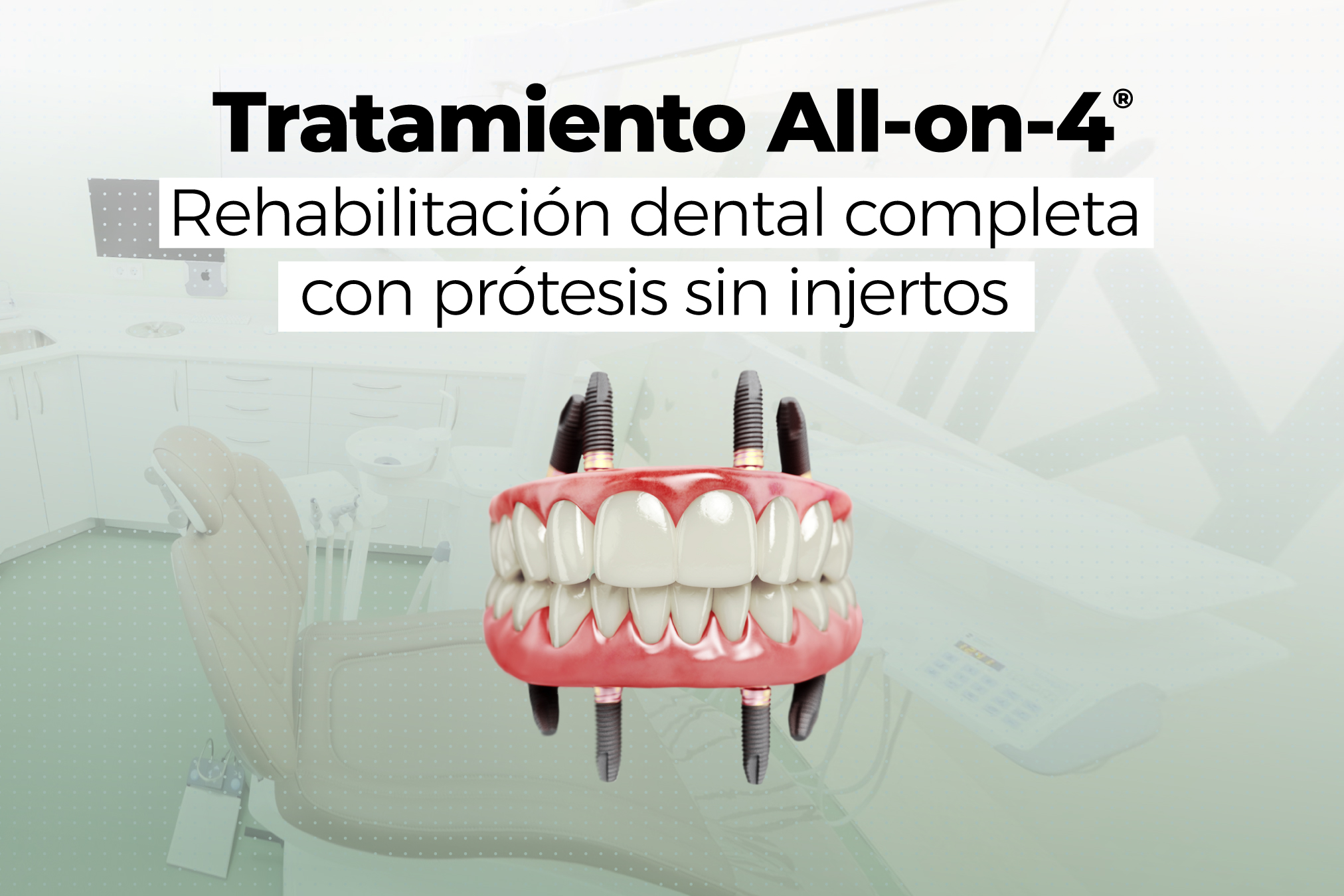 Tratamiento All-in-4